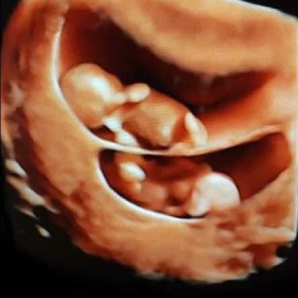 Meet your Posher, Renee - Picture 1 of 1